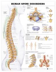 27480-9970 - Human Spine Disorders